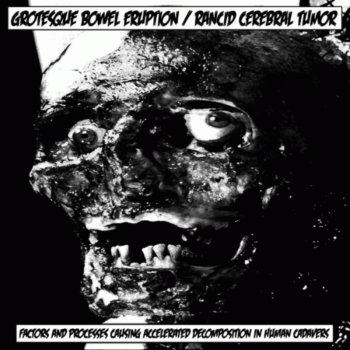 Grotesque Bowel Eruption : Factors & Processes Causing Accelerated Decomposition in Human Cadavers